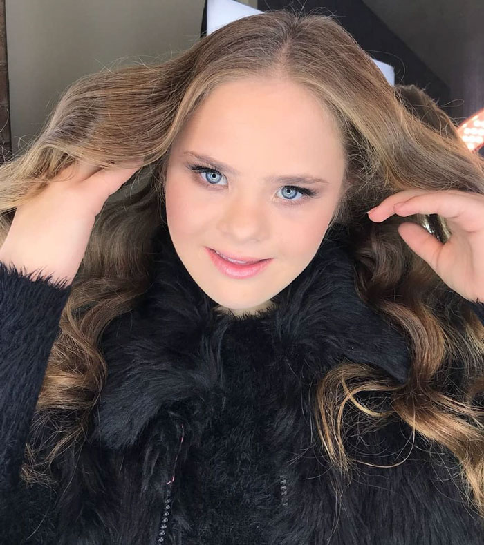 Meet This Teen With Down's Syndrome Who Has Already Signed For 5 Modeling Agencies And Has 50k Followers On Instagram