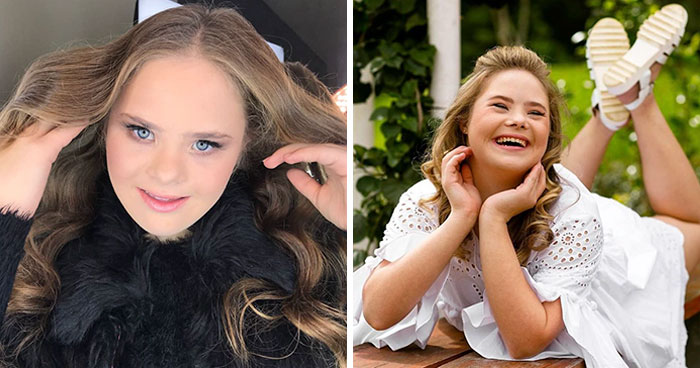 Meet This Teen With Down’s Syndrome Who Has Already Signed For 5 Modeling Agencies And Has 50k Followers On Instagram