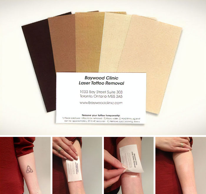 To Promote Their Laser Tattoo Removal Services Baywood Clinic Created These Temporary Tattoo Business Cards
