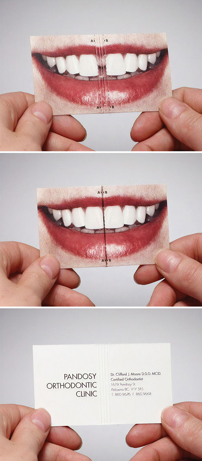 This Creative Business Card Was Done For An Orthodontist. When The Card Is Folded Together, The Gap In The Teeth Disappears