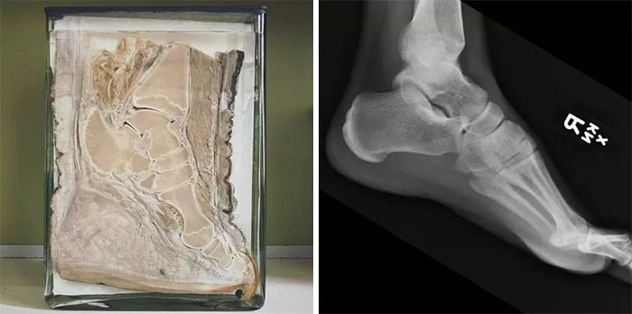 Elephants Foot Compared To Humans Foot