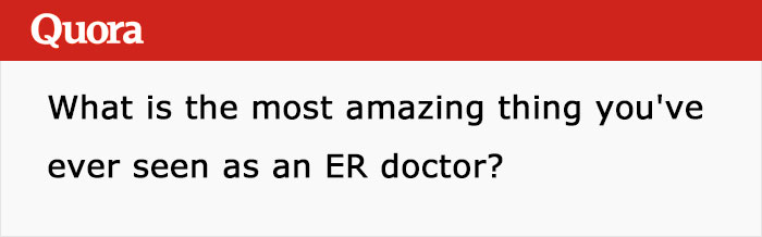 Someone Asks ER Doctors What Are The Most Amazing Things They Have Seen, And This Answer Wins