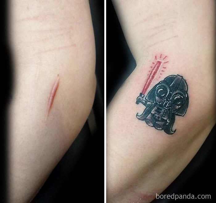 Scar Tattoo