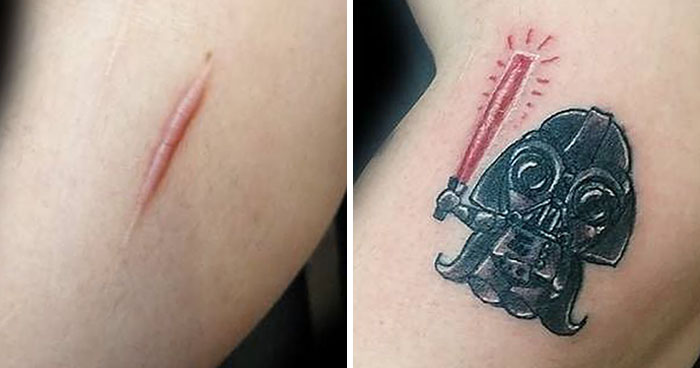 25 Times People Asked To Cover Up Their Scars And Birthmarks, And Tattoo Artists Nailed It