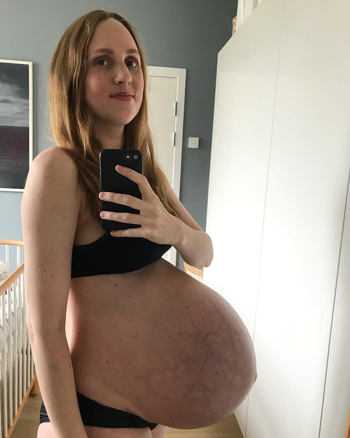 Woman Who Stunned The World With Her Huge Baby Belly, Shows What Giving Birth To Triplets Does To Your Body