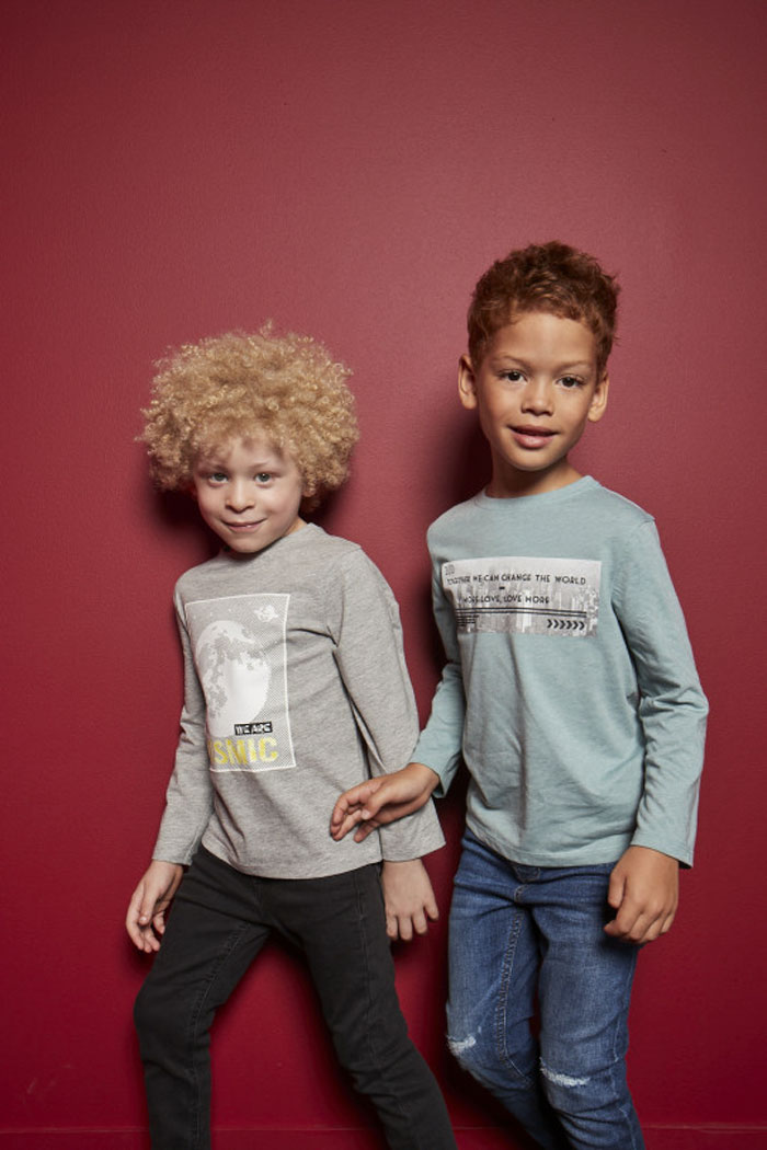5-Year-Old Albino Boy Becomes Model For Primark After Mum Shares His Pic On Facebook