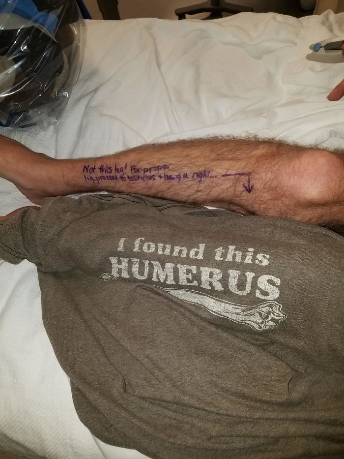 I'm Having My Left Leg Amputated Today. I Wore This Shirt And Wrote This On My Leg For The Surgeons