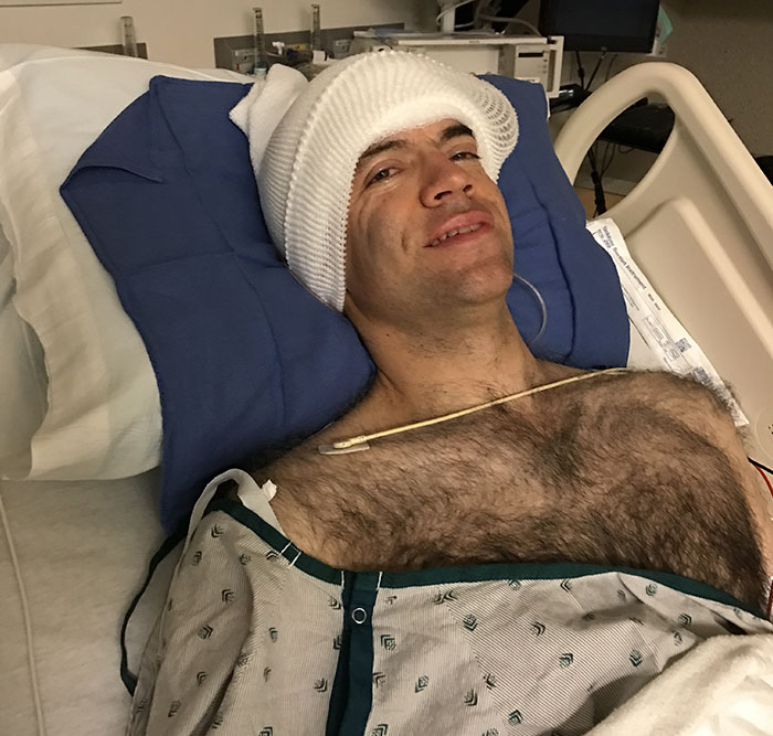 Guy Who Was Supposed To Live For 6 Years After Brain Cancer Diagnosis, Lives For 20+ Years, Beats It 4 Times