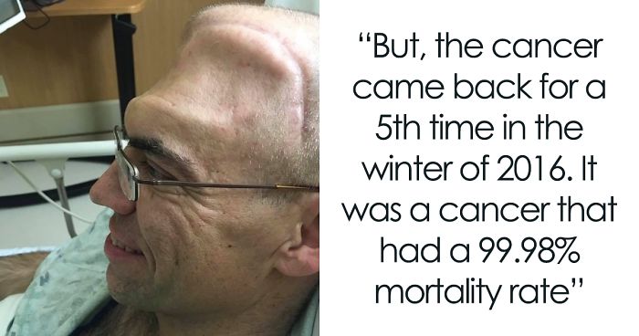 Guy Who Was Supposed To Live For 6 Years After Brain Cancer - 