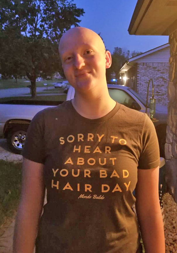 My Daughter's Friend, Who Has Alopecia, Wore This Shirt To School Today