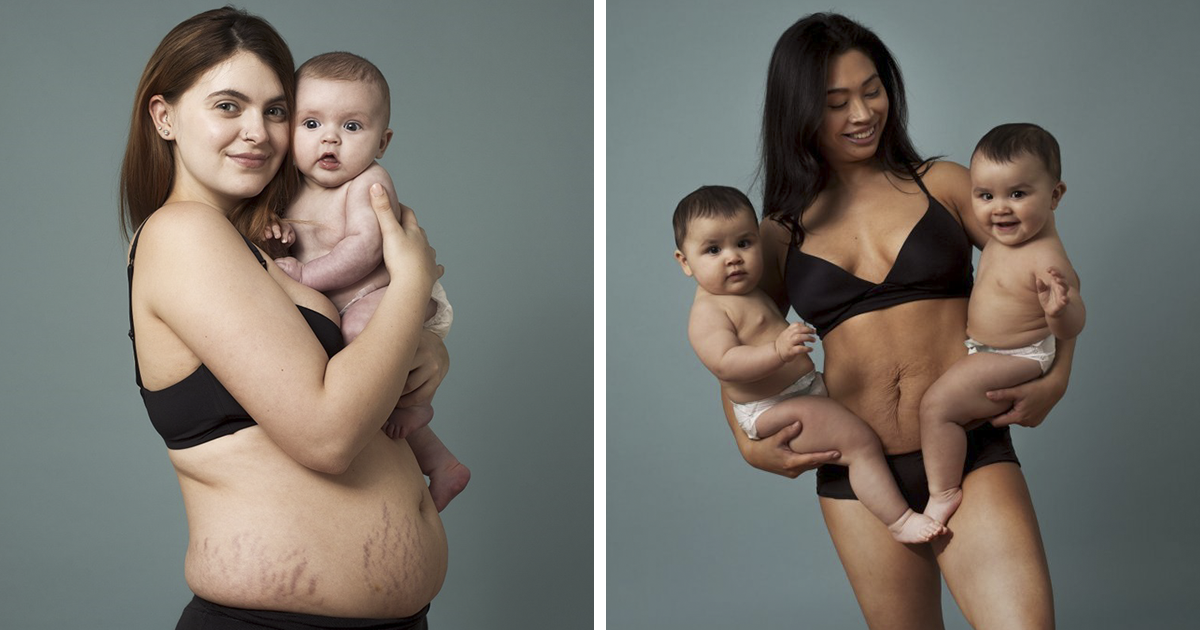 This Campaign Celebrates Postpartum Bodies To End Unrealistic Expectations  For New Moms