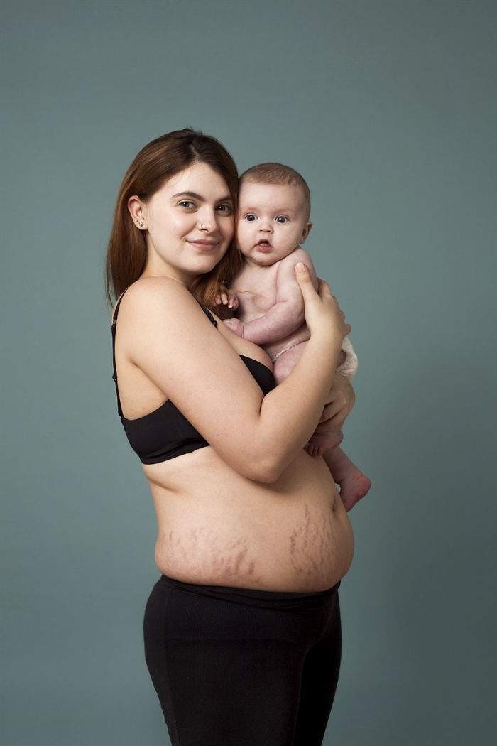 This Campaign Celebrates Postpartum Bodies To End Unrealistic Expectations For New Moms