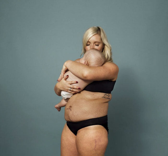 This Campaign Celebrates Postpartum Bodies To End Unrealistic Expectations For New Moms