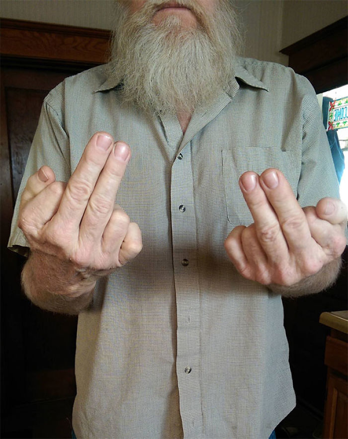 Mi padre tiene 6 dedos en cada mano, usa 2 dedos para hacer la peineta