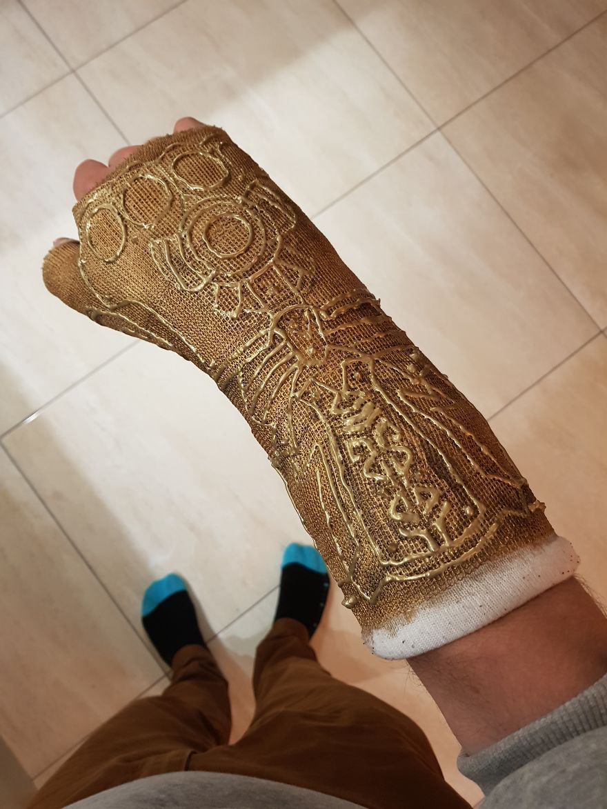 After Breaking My Wrist, I Turned My Plain Cast Into Thanos‘ Infinity Gauntlet
