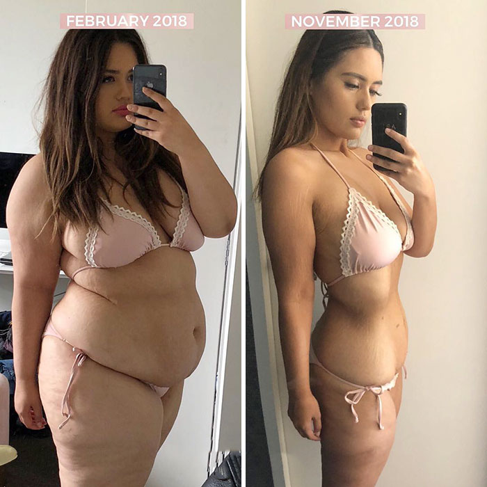 Woman Reveals Before-And-After Pictures Of Her 141-Pound Weight Loss, And She's Completely Transparent About It