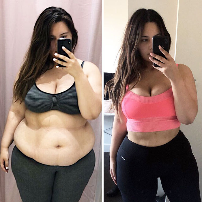 Woman Reveals Before-And-After Pictures Of Her 141-Pound Weight Loss, And She's Completely Transparent About It