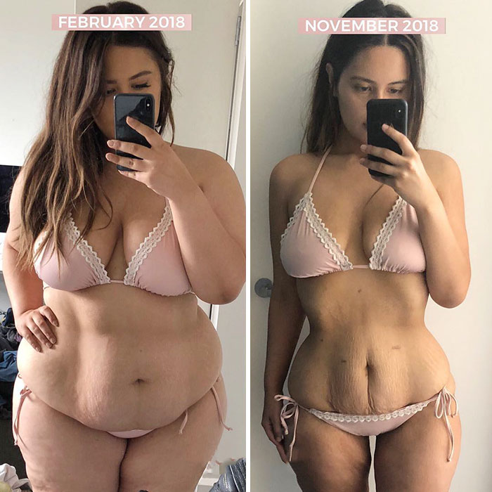Esta mujer revela sus fotos antes y después de perder 64 kilos y no oculta nada