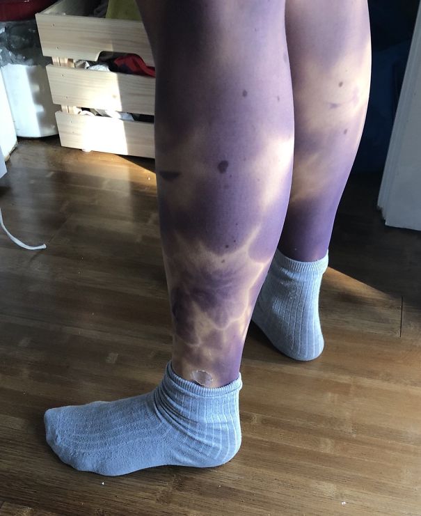 These Tights That Make You Look Like You Have The Worst Bruise Situation Ever