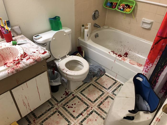 My Son Busted His Lip And Our Bathroom Looked Like Someone Had Been Murdered