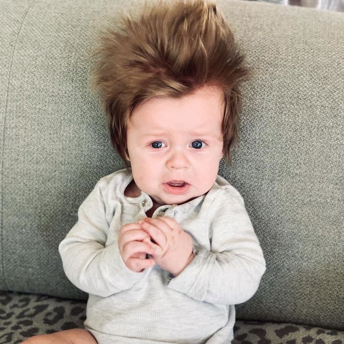 A Four-Month-Old Baby From Australia Has A Head Full Of Lush Hair That Causes A Stir Wherever He Goes