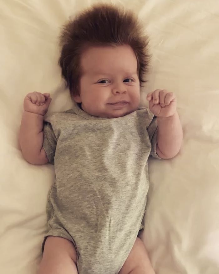 A Four-Month-Old Baby From Australia Has A Head Full Of Lush Hair That Causes A Stir Wherever He Goes