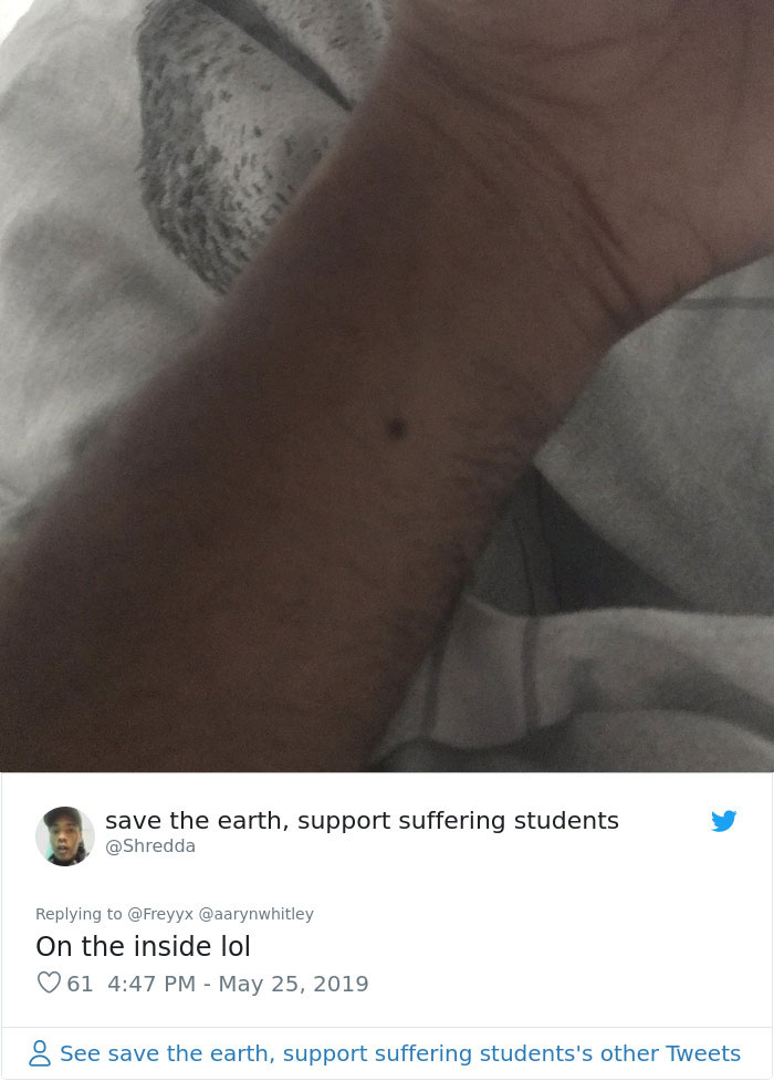 Someone Claims All Women Have A Freckle In The Middle Of Their Wrists, And People Start Freaking Out (23 Pics)