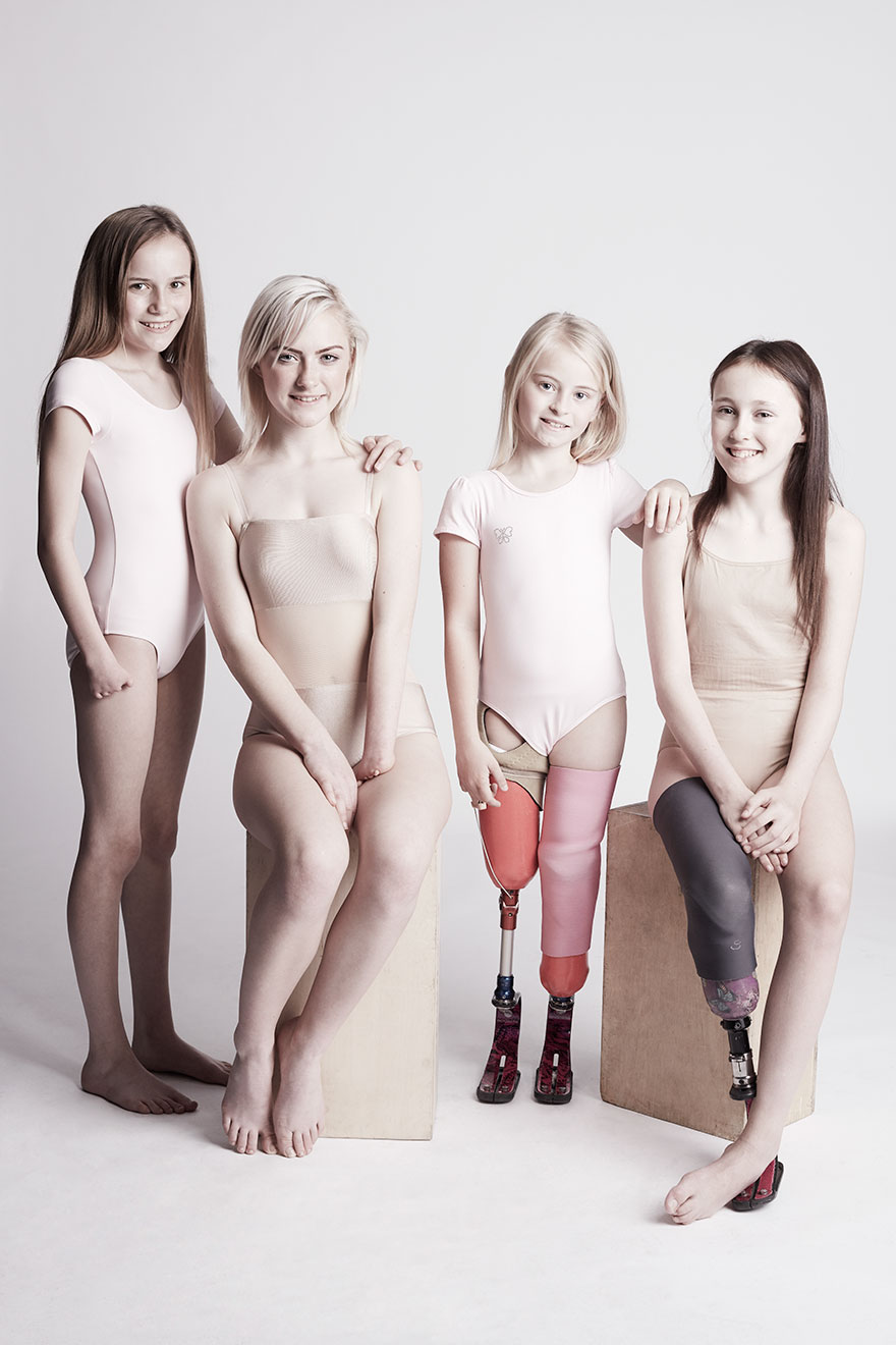 We Photographed 19 People With Limb Differences Aged From 2 To 54 In Body Confidence Shoot
