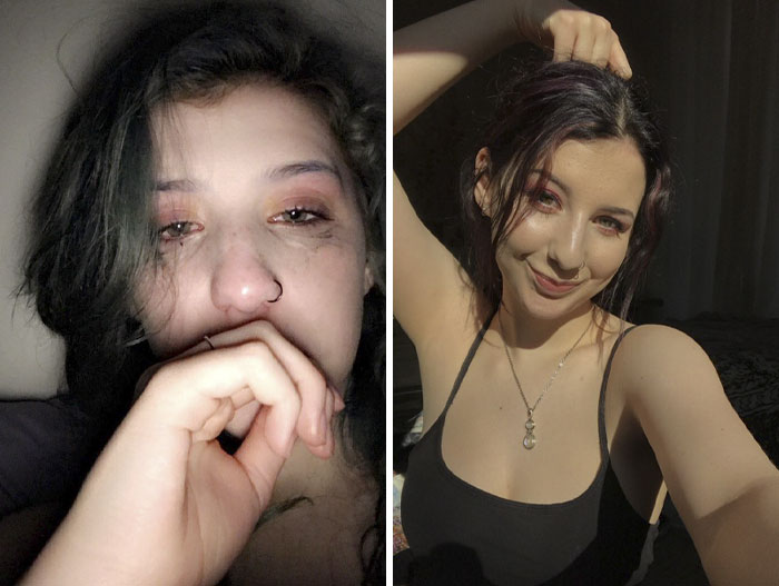 Teen Shows The Difference Mental Health Glow Up Made To Her Appearance, Inspires Others To Post Their Pics