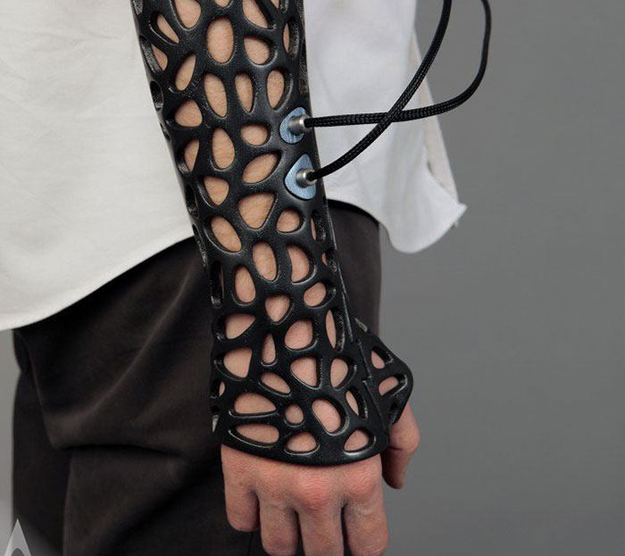 3D-Printed Plastic Cast That Uses Ultrasound To Heal Broken Bones Faster