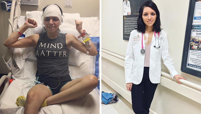 After Surviving 6 Major Brain Surgeries, This Woman Is Aiming To Become A Doctor