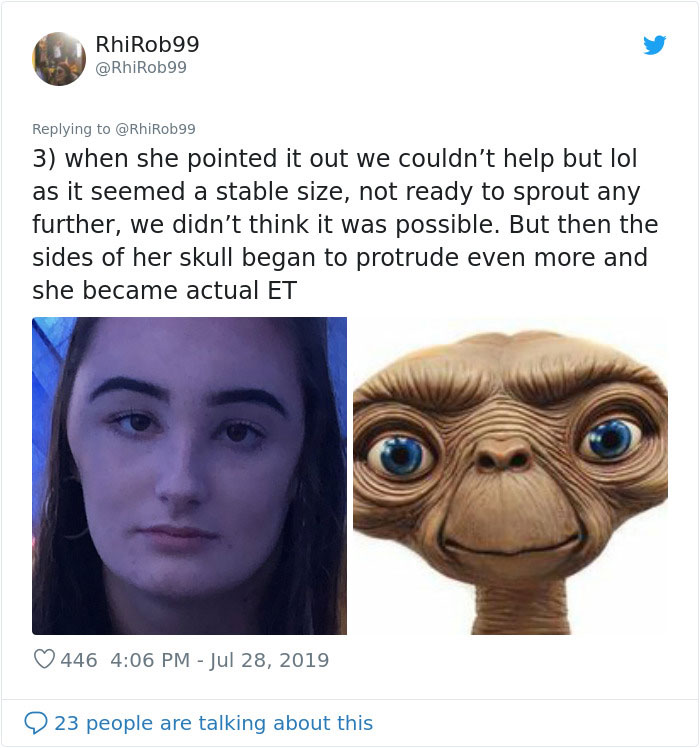 Girl Starts To Look Like An Alien Due To Swelling Head, Does Nothing Until Her Eyes Almost Swell Shut