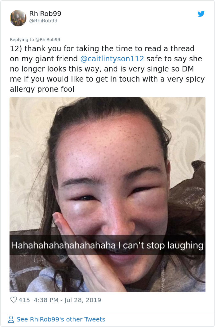 Girl Starts To Look Like An Alien Due To Swelling Head, Does Nothing Until Her Eyes Almost Swell Shut