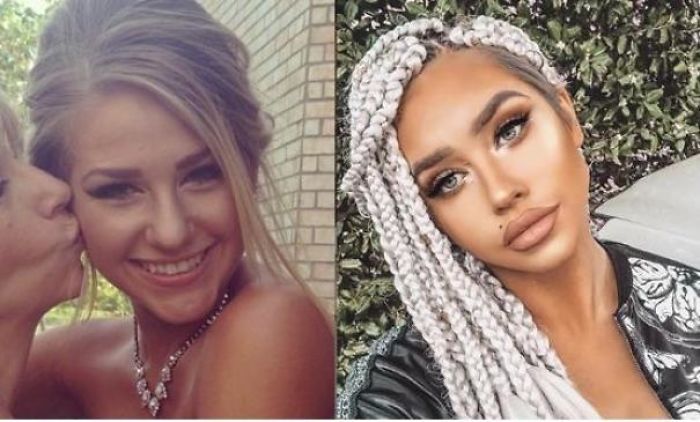 Photo On Left Is From When She First Joined Instagram. Photo On Right Is Recent And After Influencer Fame. Might As Well Be A Different Person.