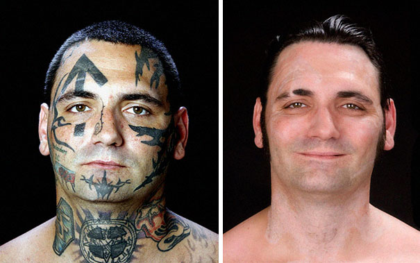 former racist nazi face tattoo removal bryon widner 1 5d4c00088468b  605 - Relembre o ex-Skinhead que se arrependeu de suas tatuagens depois de ser pai