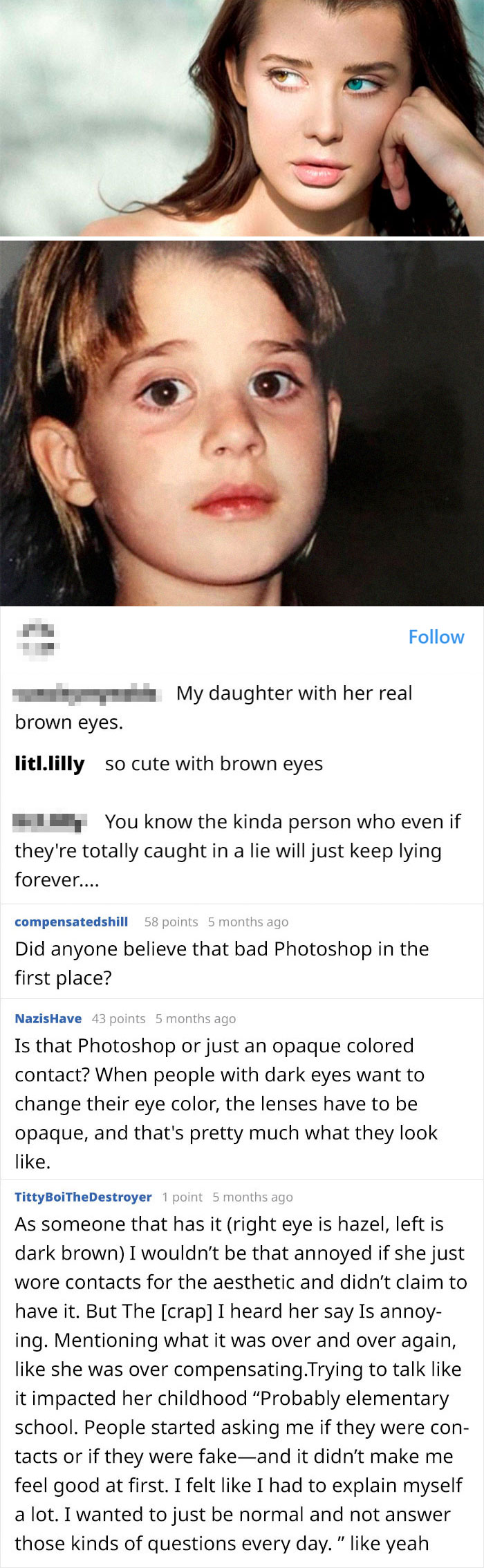 Instagram "Influencer" Called Out By Her Own Dad For Claiming To Have Heterochromia