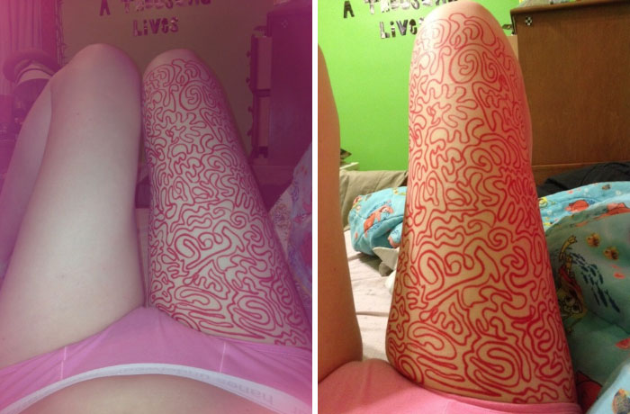Girl Shares Therapist's Advice To Draw On Her Body Instead Of Cutting