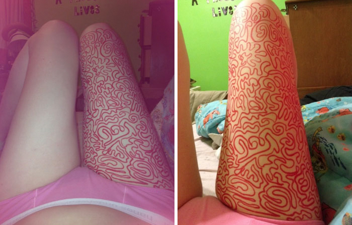 Girl Shares Therapist’s Advice To Draw On Her Body Instead Of Cutting