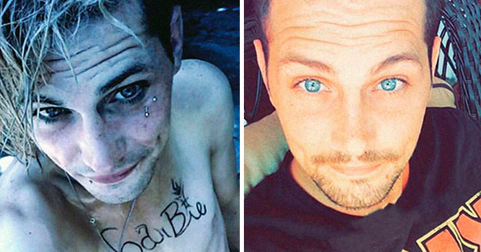 38 Stunning Before & After Transformations Of People Who Quit Drugs