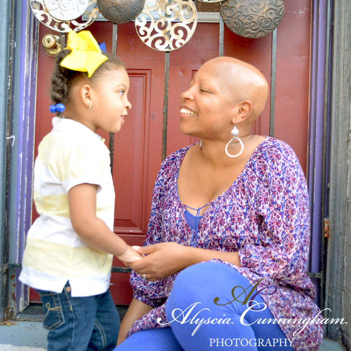 I'm Shedding Some Truth On Female Baldness: It's Not Always Cancer