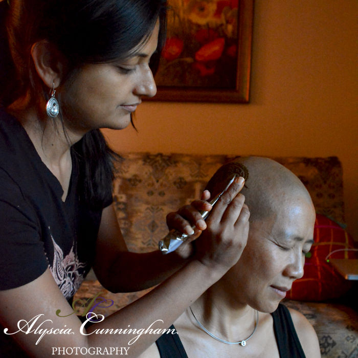 I'm Shedding Some Truth On Female Baldness: It's Not Always Cancer