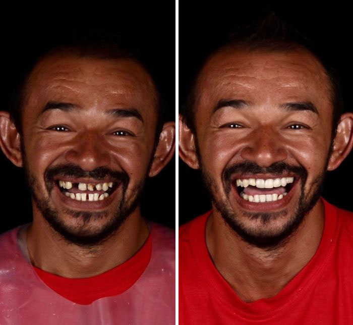 Brazilian-Dentist-Travel-Poor-People-Teeth-Fix-Felipe-Rossi