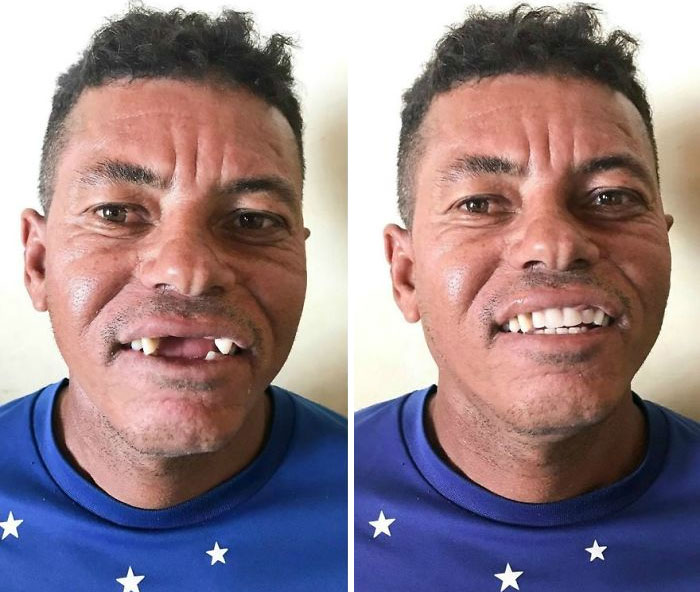 Brazilian-Dentist-Travel-Poor-People-Teeth-Fix-Felipe-Rossi