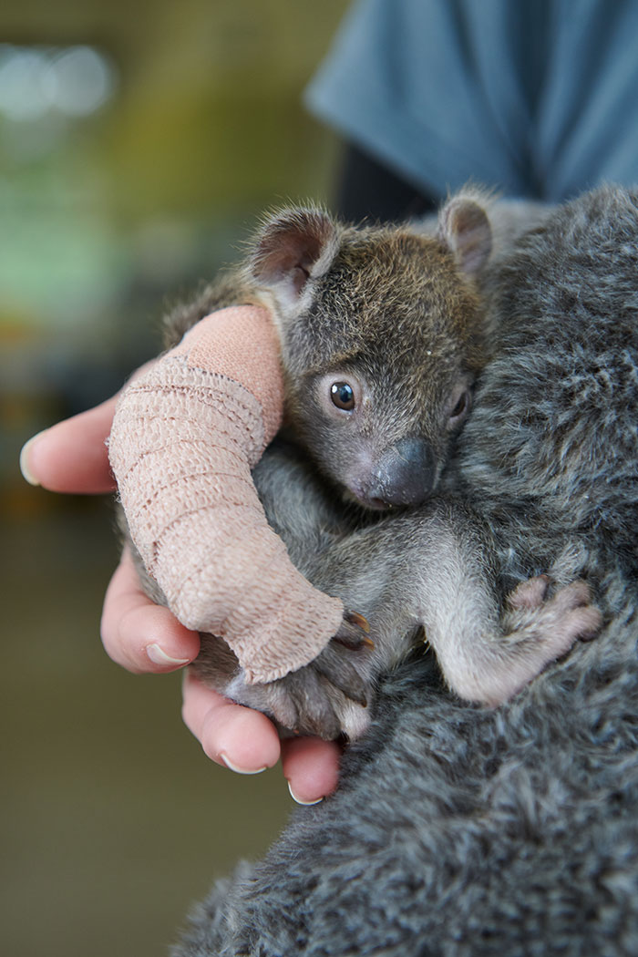 Orphaned 150-Day-Old Baby Koala Gets Tiny Arm Cast After Falling From A Tree