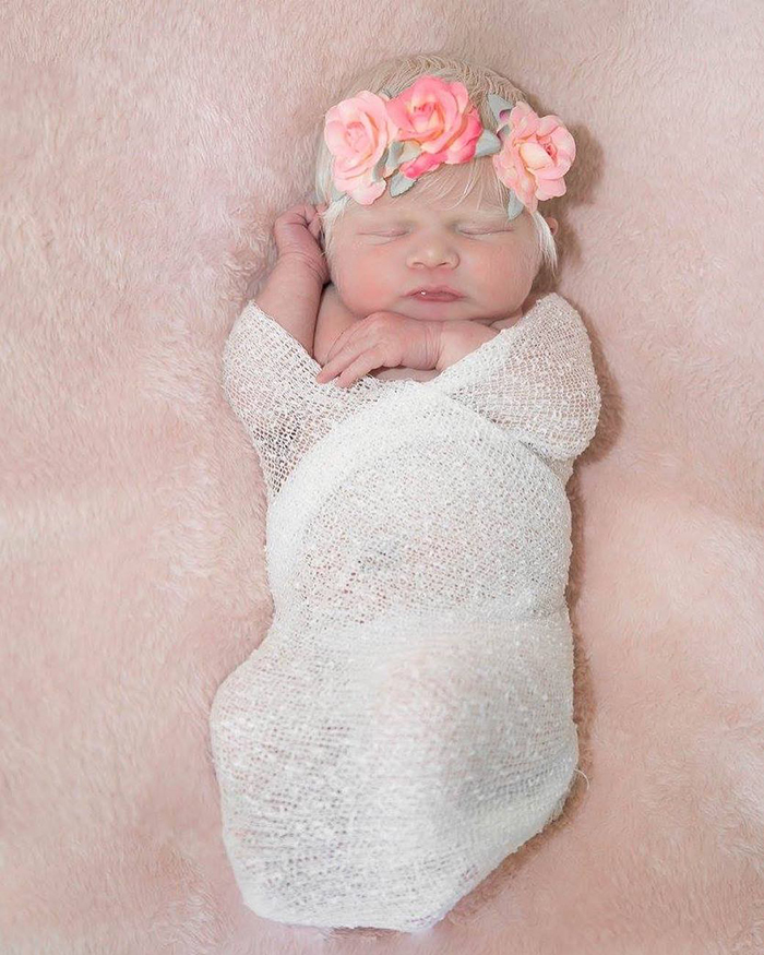 Mexican-American Parents Are Shocked After Giving Birth To A Blond Baby Girl With Light Skin