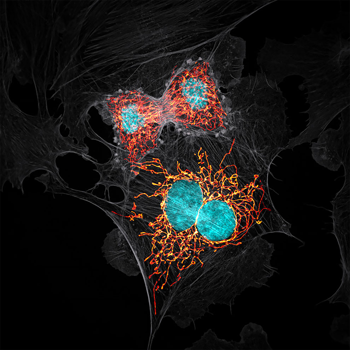 BPAE Cells In Telophase Stage Of Mitosis best micro photography 2020