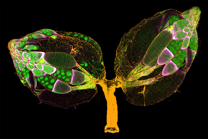 A Pair Of Ovaries From An Adult Drosophila Female Stained For F-Actin (Yellow) And Nuclei (Green); Follicle Cells Are Marked By Gfp (Magenta)