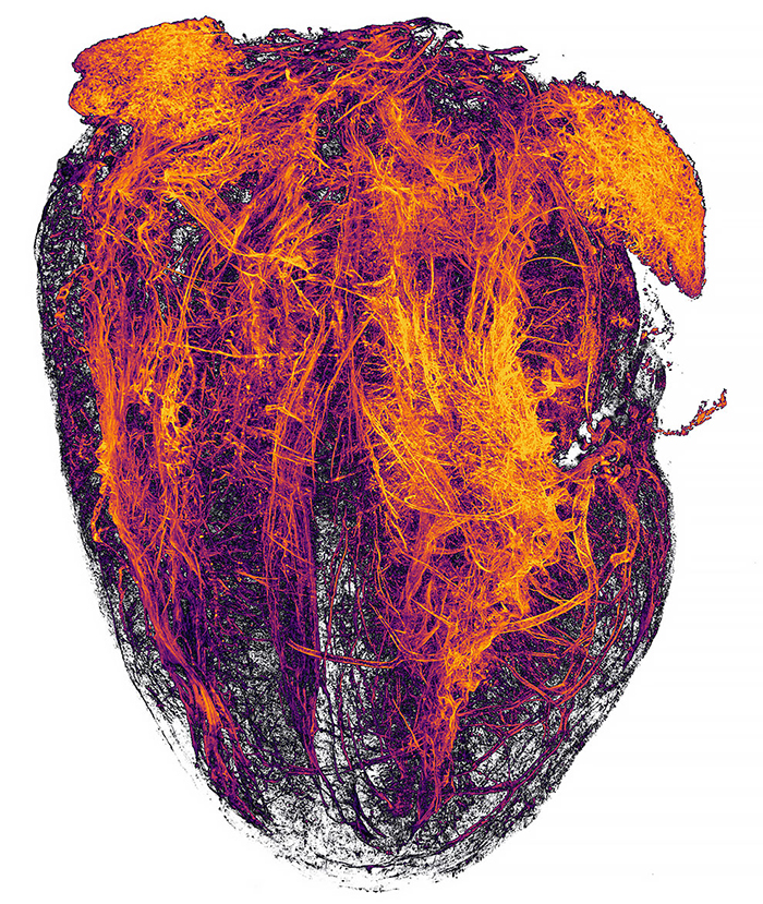 Blood Vessels Of A Murine (Mouse) Heart Following Myocardial Infarction (Heart Attack)