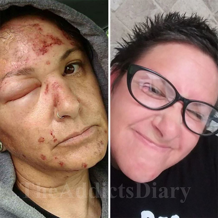 Addicts-Diary-Before-After-Photo
