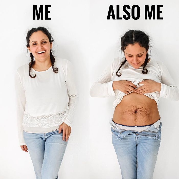 Mom Of 5 Shares Her Belly Photo To Celebrate The Beauty Of Woman Body